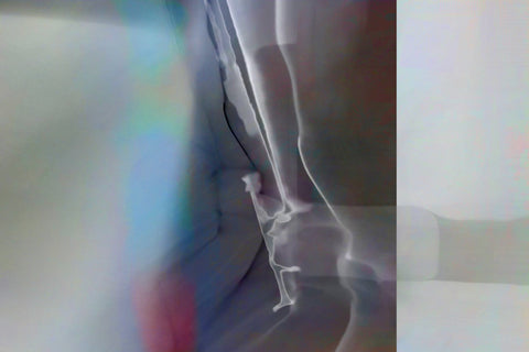 Eckhard Schwarzenberger - Non Spezific Area 78